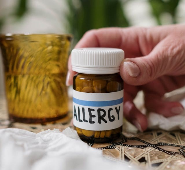 What to expect from allergy testing: Before, during, and after